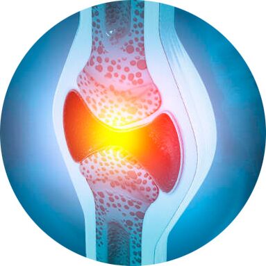 Icexin jel ile derz restorasyon süreci